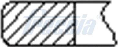 Freccia FR10-975300 - Kit fasce elastiche www.autoricambi360.it
