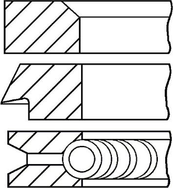 TRW 9501700 - Kit fasce elastiche www.autoricambi360.it
