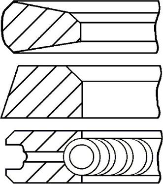 TRW 9213465 - Kit fasce elastiche www.autoricambi360.it